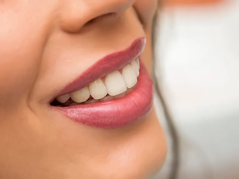 Estetik Diş Hekimliği Nedir? Estetik Diş Hekimliği Nedir?